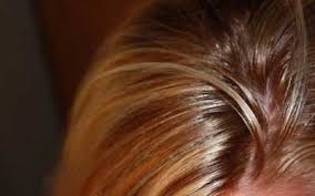 راهکارهایی برای مقابله با موهای چرب
