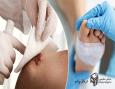  پلاسما تراپی زخم؛ روشی نوین برای درمان زخم و سوختگی